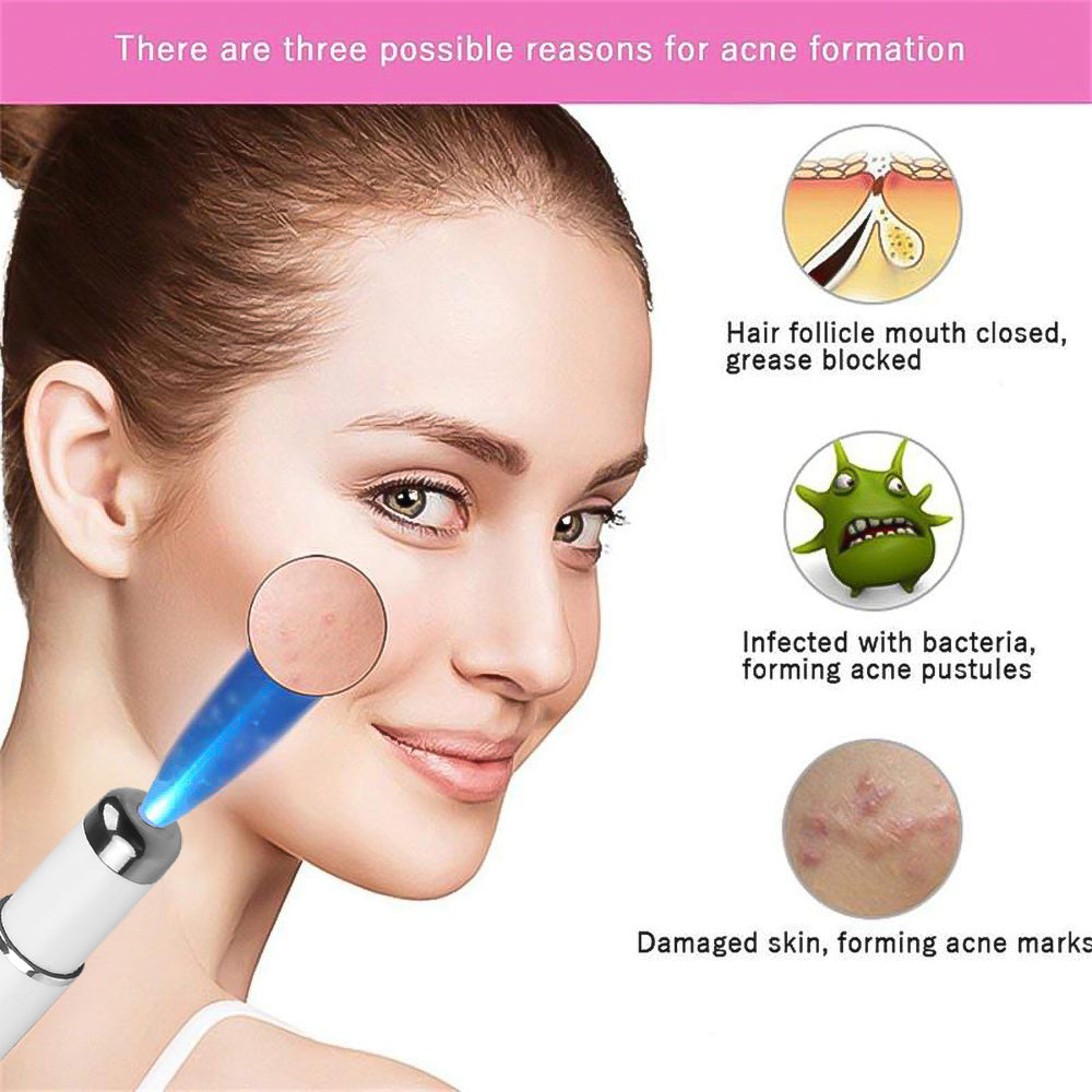 Acne Wrinkle Removal Laser Pen Skincare Machine Radio Frequency Skin Tightening Anti Varicose Blue Light Plasma Beauty Appliance